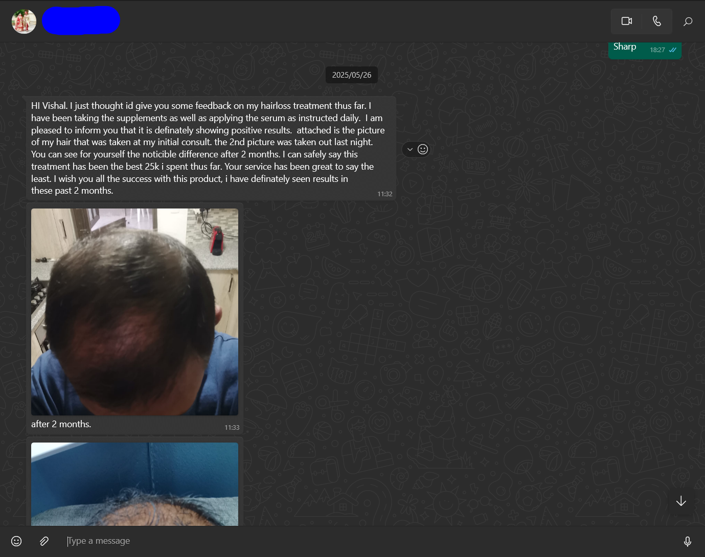 Hair aGain Follicle Revival System